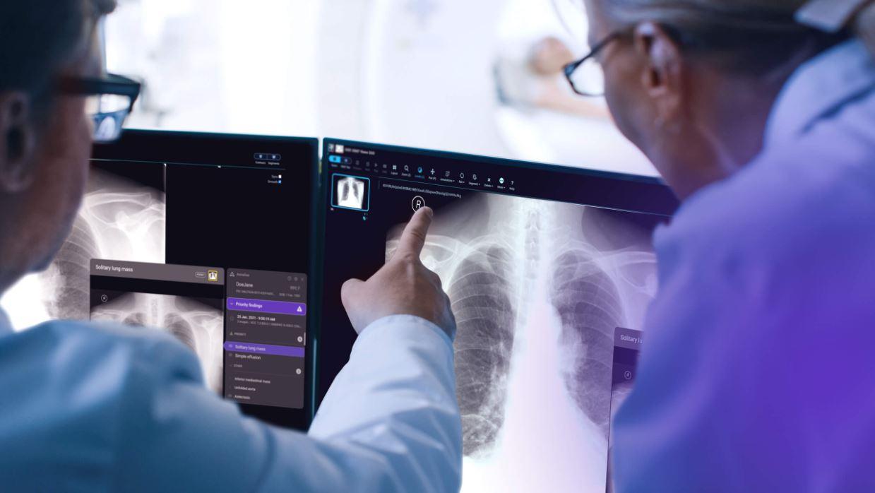 AI trong đọc ảnh y tế: Một tiềm năng lớn đang bị bỏ lỡ