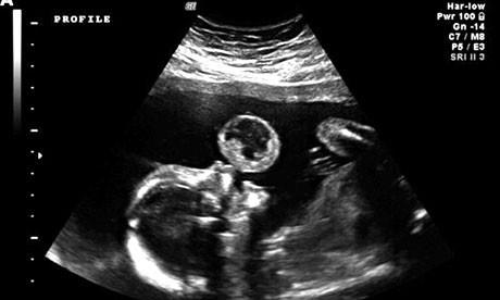 Trung Quốc: Nỗi ám ảnh đeo đẳng về chính sách một con