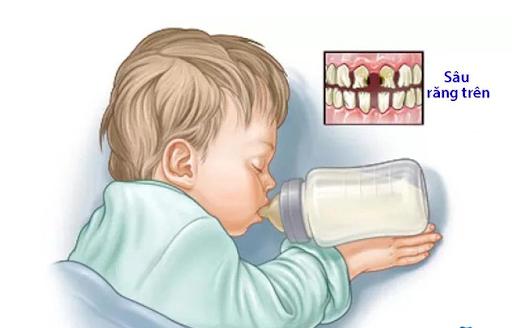 Thói quen mút ngón tay và bú bình của trẻ có ảnh hưởng đến răng và xương hàm không?