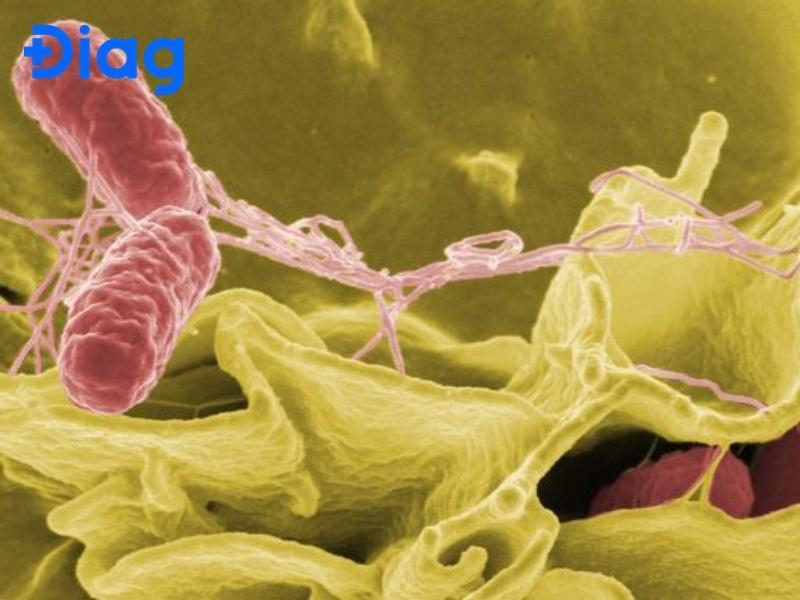 Trùng kiết lị là gì? Bệnh kiết lị nguy hiểm như thế nào?