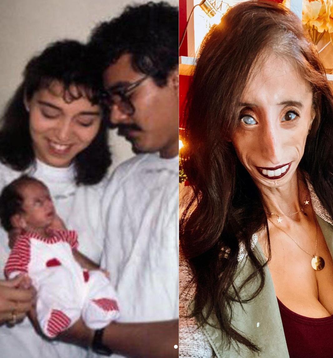 Sinh ra với diện mạo kỳ lạ, cô gái "xấu nhất thế giới" giờ ra sao?