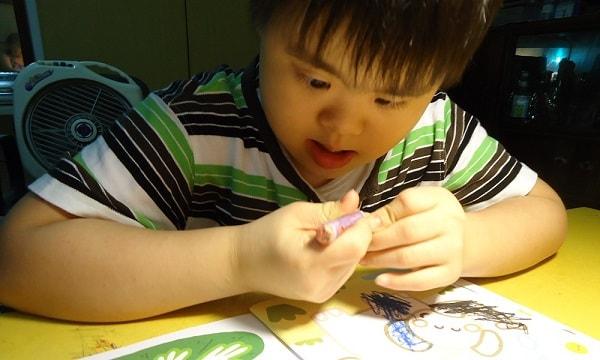 Dấu hiệu và triệu chứng của trẻ bị thiểu năng trí tuệ