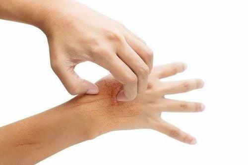 U xương là bệnh gì? Các loại u lành tính ở xương